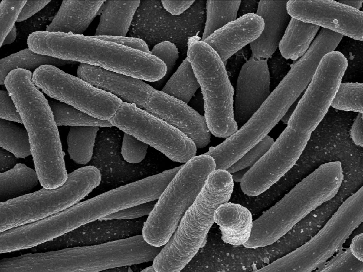 Bakterien der Art Escherichia coli (kurz: E. coli) können nützliche Darmbakterien, Krankheitserreger, aber auch Hilfsmittel der Biotechnologie sein.